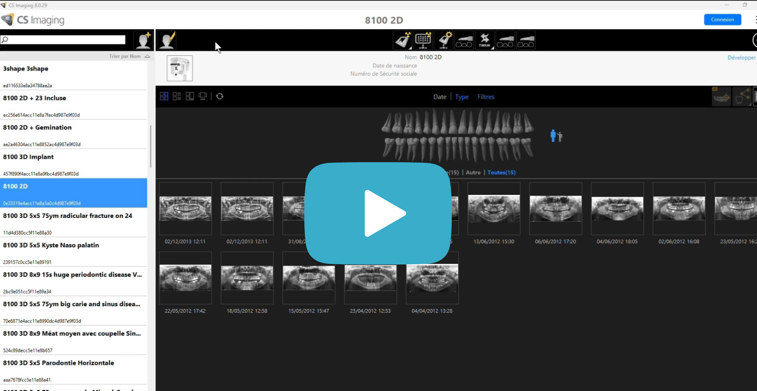Video Thumbnail