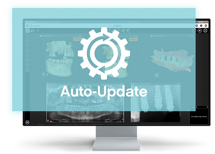 Auto-Update