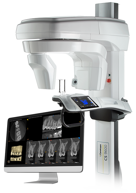 CS9600_AAE.png
