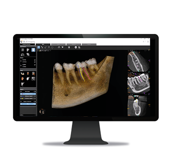 Endodontie