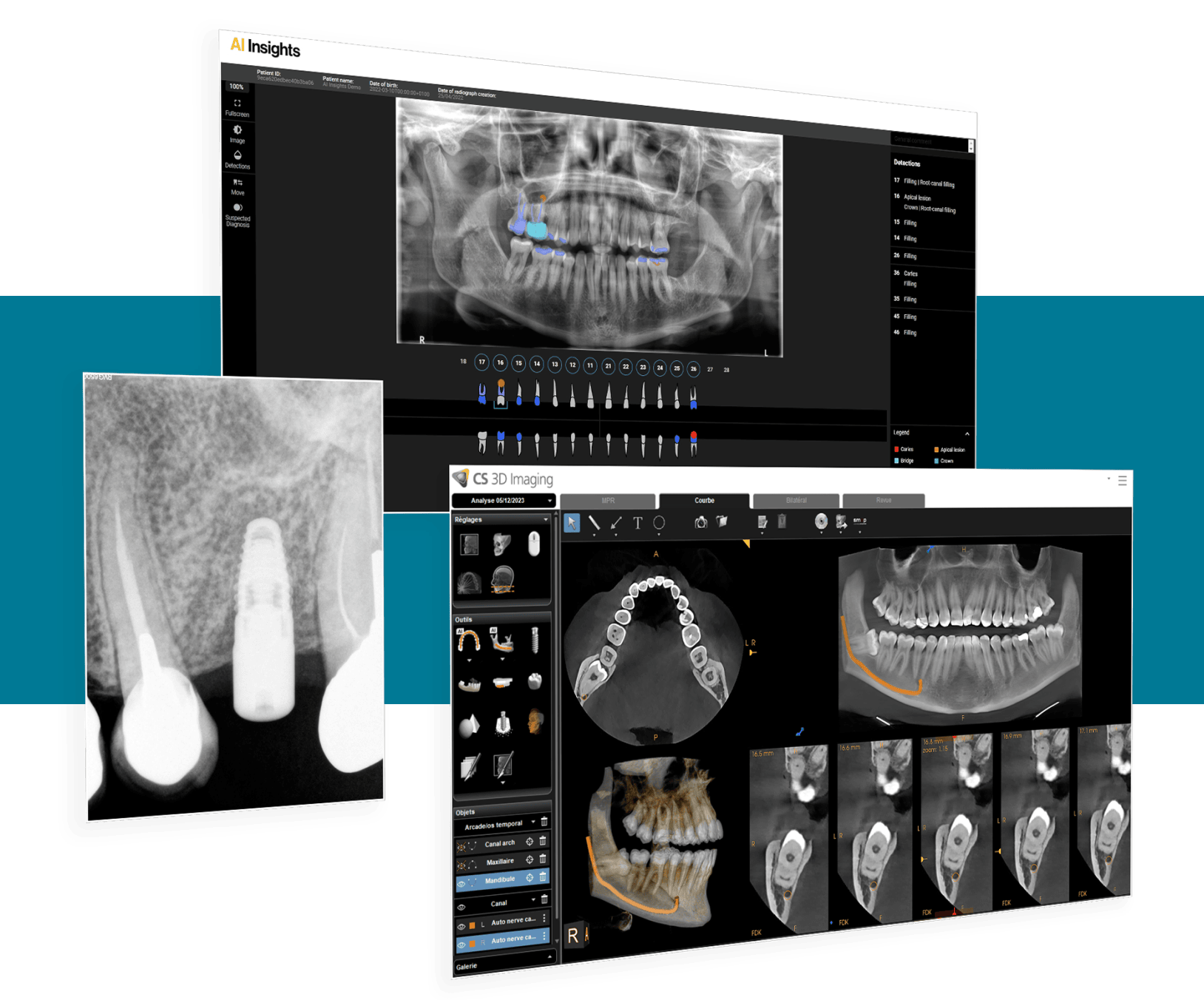 Carestream Dental Precision Campaign carestream-dental-precision-campaign