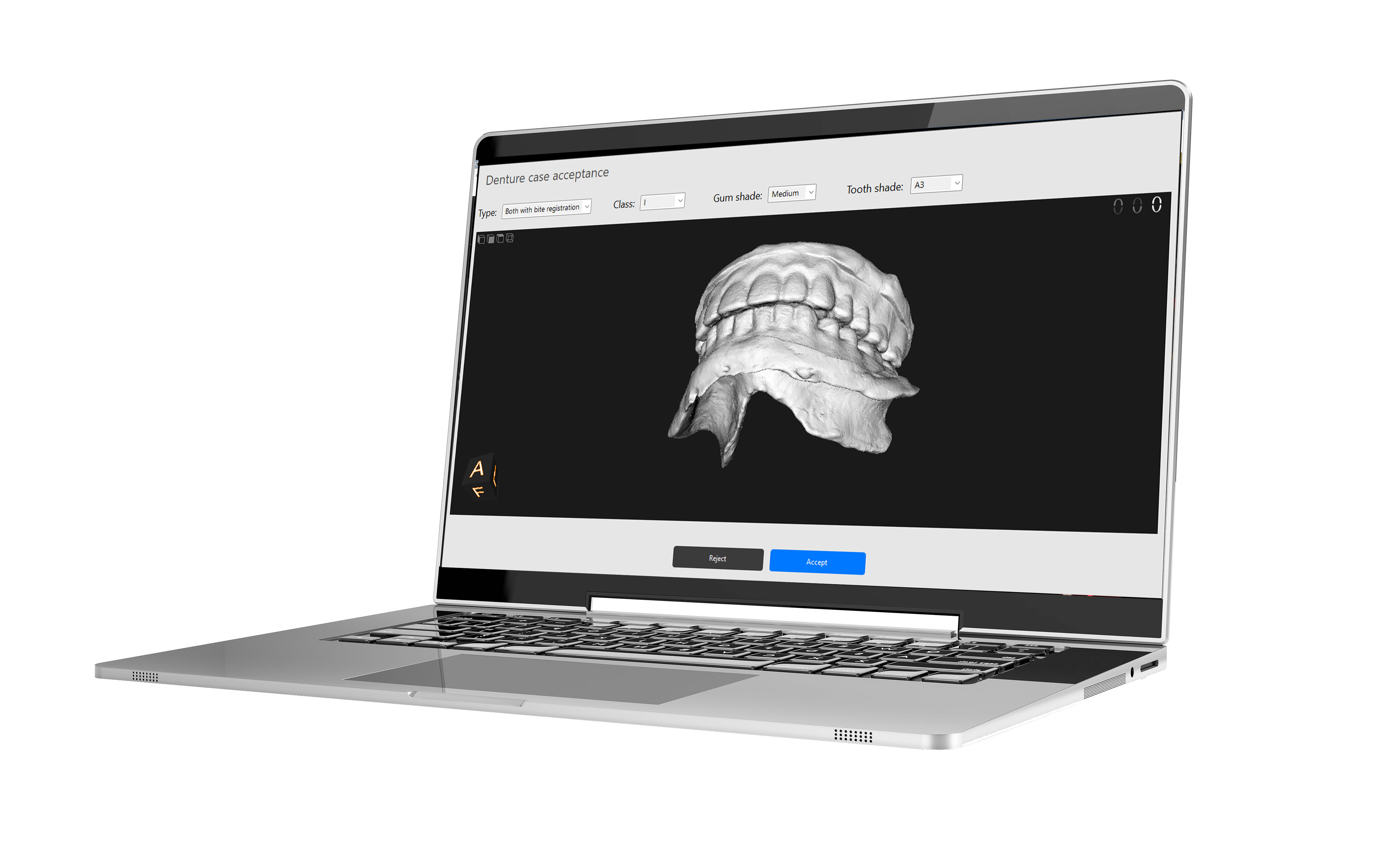 digital-denture-laptop.png